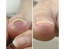 アールイードット(Re.)の雰囲気（巻き爪ケアもご相談ください）