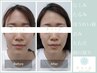 首肩こり.頭痛,お顔のむくみに《ヘッドスパor首肩こり＋小顔》効果実感60分