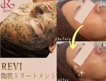 プレシャス(Precious)