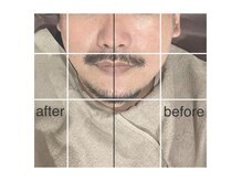 グリシーヌ(GLYCINE)/メンズ痩身の効果★