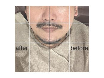 グリシーヌ(GLYCINE)/メンズ痩身の効果★