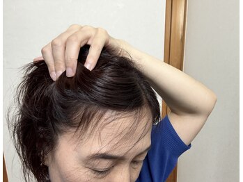 小顔専門サロン ラリューシュ(La ruche)/頭皮の健やかさが若さの秘訣