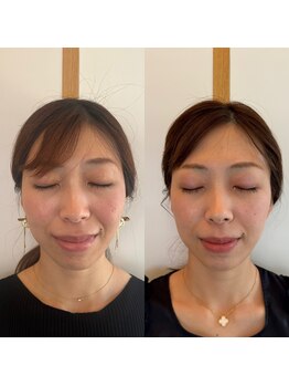 こうぞう整体院/美容鍼×筋膜リリース