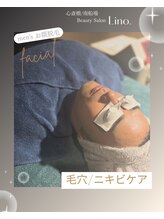 リノ(Lino.)/メンズ☆透明感UPの髭脱毛が人気