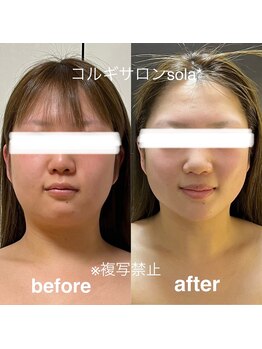ソラ(sola*)/圧倒的小顔!