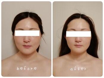 ホワイトサロンファミリア(whitesalon familia)/ブライダル小顔コルギ