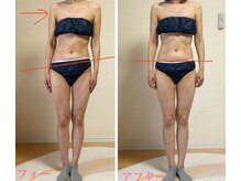 高槻 インサイド(Inside)/40代お客様当日ビフォーアフター