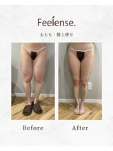 フィーレンス(Feelense.)/太もも、痩身、短期痩せ、減量