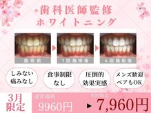 ホワイトニングカフェ 黒崎店(WhiteningCafe)