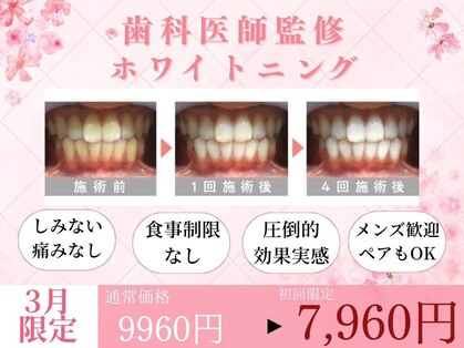 ホワイトニングカフェ 黒崎店(WhiteningCafe)の写真