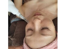 モア(MOA)の雰囲気(エクソソーム美容/小顔/細胞活性/頭皮ケア/ヘッド/年齢肌ケア)