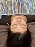 《整う美容鍼コース》写真の貴方…疲れた顔に写っていませんか？￥13000