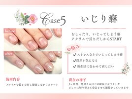 いじり癖の悩みビフォーアフター