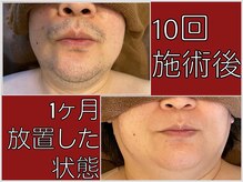 ファシネイト 新宿本店(Fascinate)の雰囲気（ヒゲ脱毛で清潔感UP！【メンズ脱毛・メンズ脱毛サロン/新宿】）