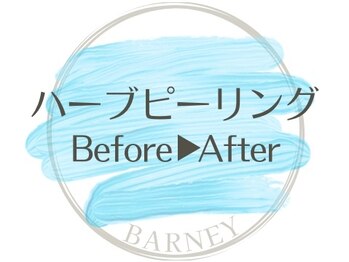 バーニー 梅田店(BARNEY)/ハーブピーリング