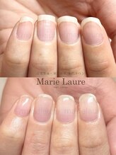 マリーロール 梅田店(Marie Laure)/深爪矯正/自爪育成/自爪風