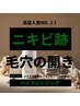 【韓国発ILLONハーブピール】プラズマorアクアピーリングset（剥離あり）