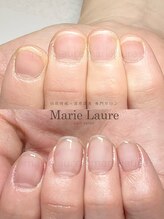 マリーロール 梅田店(Marie Laure)/深爪矯正/自爪育成/ネイルケア