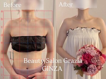 グラツィア 銀座(Grazia)/9回【 ブライダルエステ整体 】