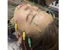 2回目の方【表情デザイン美容鍼】