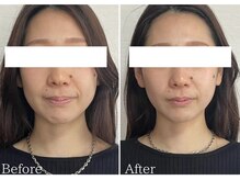 リタ(Rita.)/綺麗な卵形のお顔に！