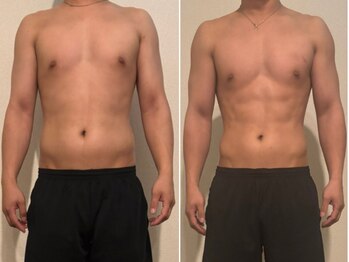 シャルマン(CHARMANT)の写真/リピート率90%超の痩身サロン銀座に登場！エステ業界10年以上のオーナーが理想の身体作りを徹底サポート♪