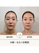 ふらっとエステ/すっきりした小顔