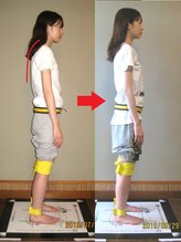 チャラク(charaku)/【30代O様：猫背矯正】