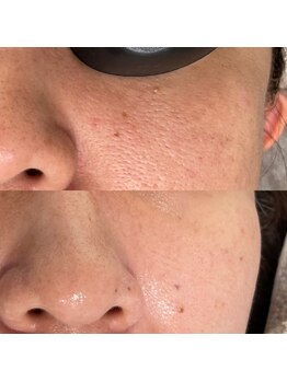 エン(enn)/【毛穴・トーンアップ】