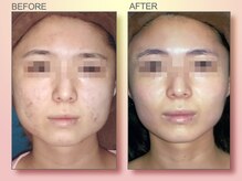 ジュリア オージェ 天王寺店/ビフォーアフター（ホワイト）