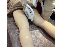 リリ(RiRi)/【脱毛】美肌脱毛