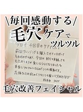 ルネッタ(Lunetta)/