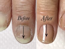 トゥインクリーネイルサロン(Twinkly Nail Salon)/【最強のネイルケア】1回お試し