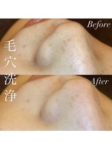 アース コアフュールボーテ 新潟紫竹山店(EARTH coiffure beaute)/毛穴洗浄
