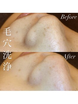 アース コアフュールボーテ 新潟紫竹山店(EARTH coiffure beaute)/毛穴洗浄
