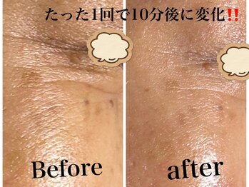 ココ(KOKO)/50代女性が1回で変化あり!