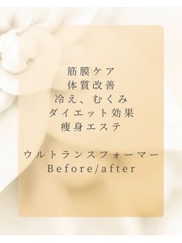 リノ(Lino.)/痩身エステ9000円～