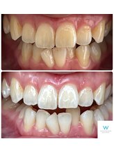 ホワイトニングショップ 奈良生駒店/歯が綺麗な大切さ