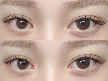 エピュレル(EPURELLE)/フラット120本