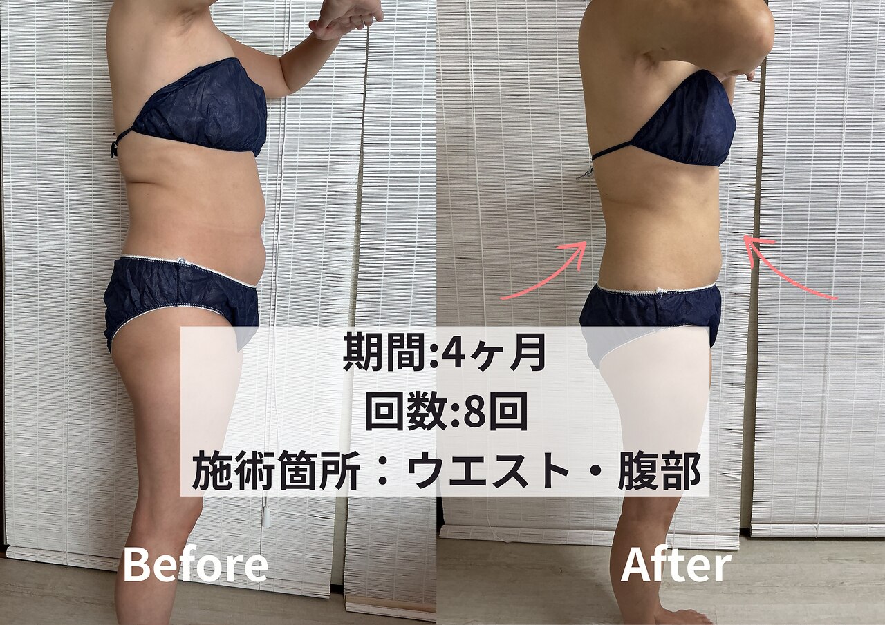 クライオ360 茅ケ崎(Cryo360)｜ホットペッパービューティー