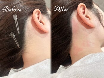 Beauty Salon PIMIL【4/4NEWOPEN(予定)】/うなじ脱毛