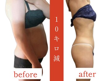 ウィズルーチェ 神栖店(with luce)/痩身効果★ダイエットに終止符を