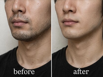 GENTLE SKIN銀座駅前店[メンズ小顔/毛穴洗浄/エステ/メンズ眉毛/メンズ脱毛/全身脱毛]の写真