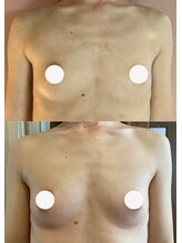 プレジール/バストボリュームアップ