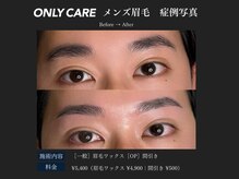 オンリィケア 関大前(ONLY CARE)/【メンズ眉毛】