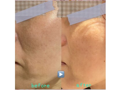 ボディスタイリング(Body Styling)の写真