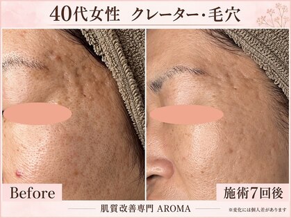 アロマ(AROMA)の写真