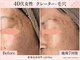 アロマ(AROMA)の写真