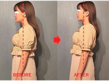 アトラス/初回のお客様のBefore＆after