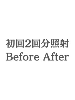 ホワイトニングカフェ 茨木店/